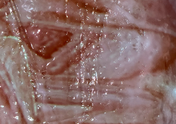 Intertwined Skins: Glitched Sublime, 2025