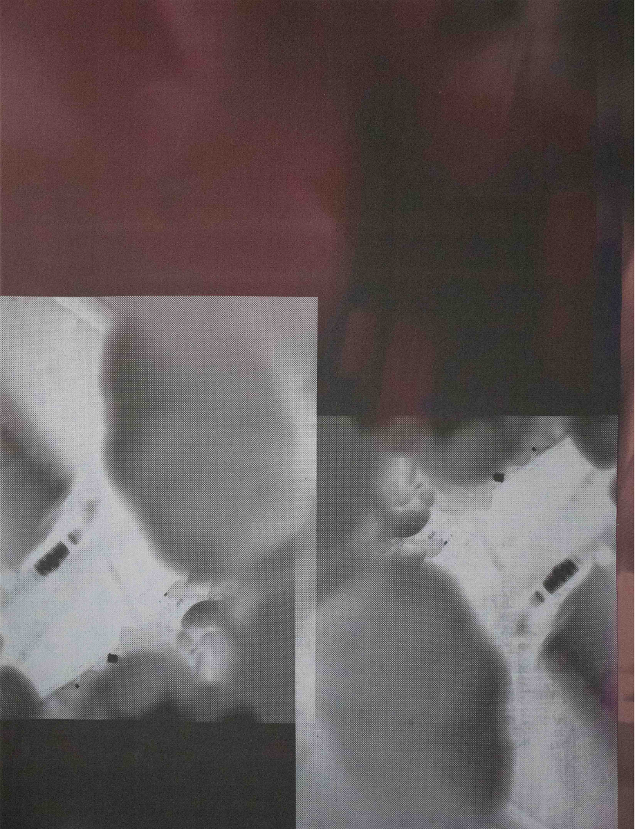 X-Ray, portfolio item 3